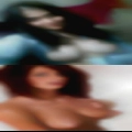 Anal Avella